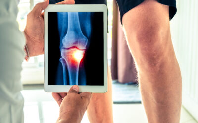 Non drug treatments for both osteoarthritis pain and depression
