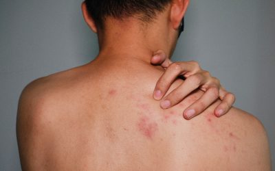 Shingles Awareness Week