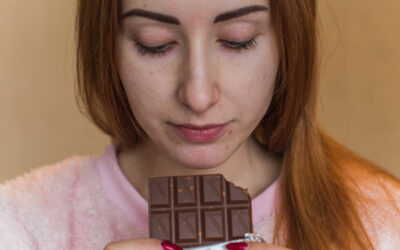 Do dairy and chocolate really make acne worse?