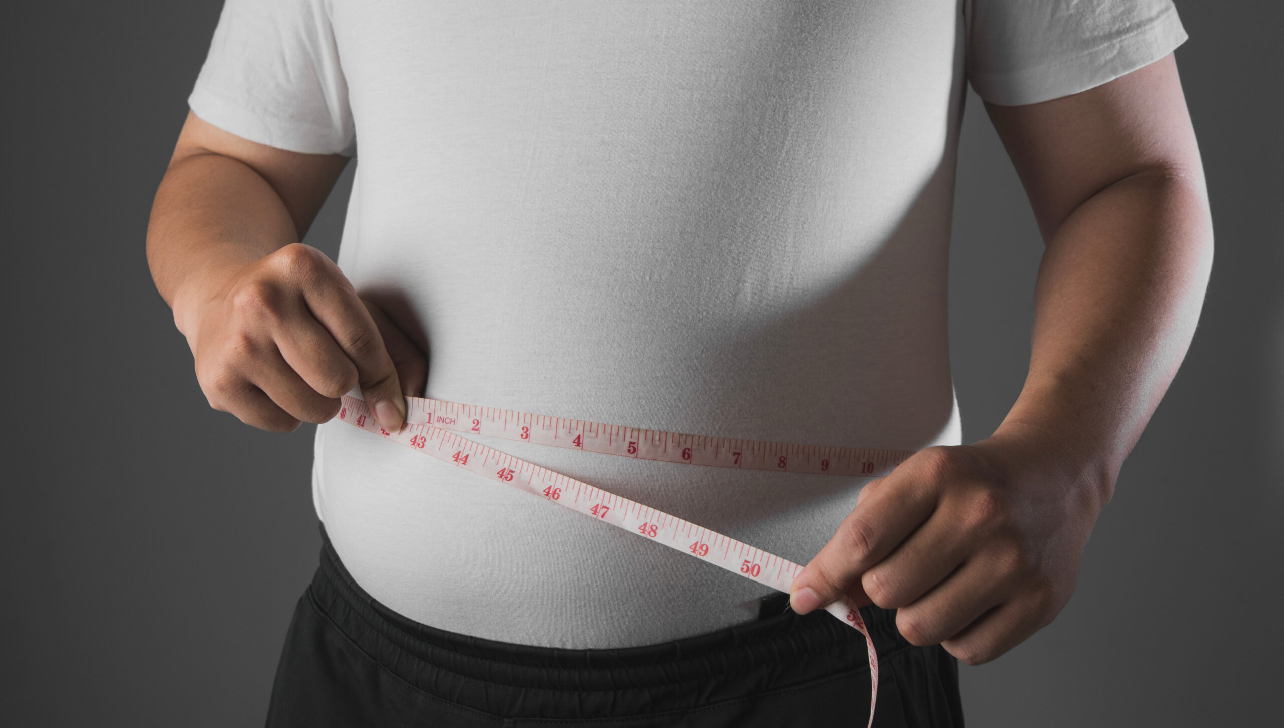 Obesity gets a definition that isn’t BMI